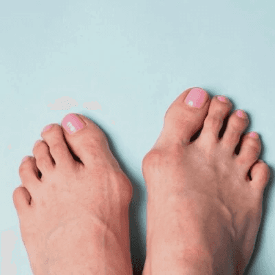 feet